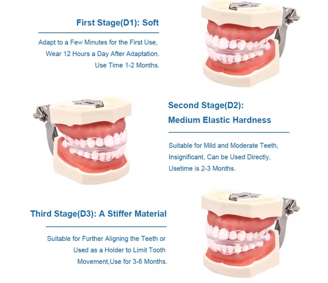 3 Stages Dental Braces