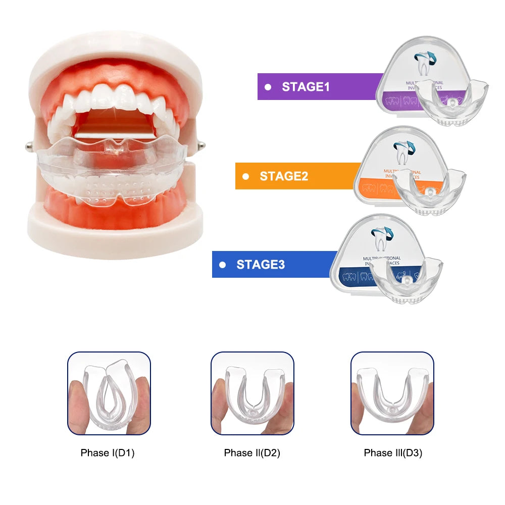 3 Stages Dental Braces