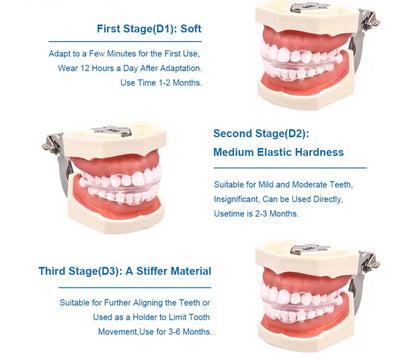 3 Stages Dental Braces